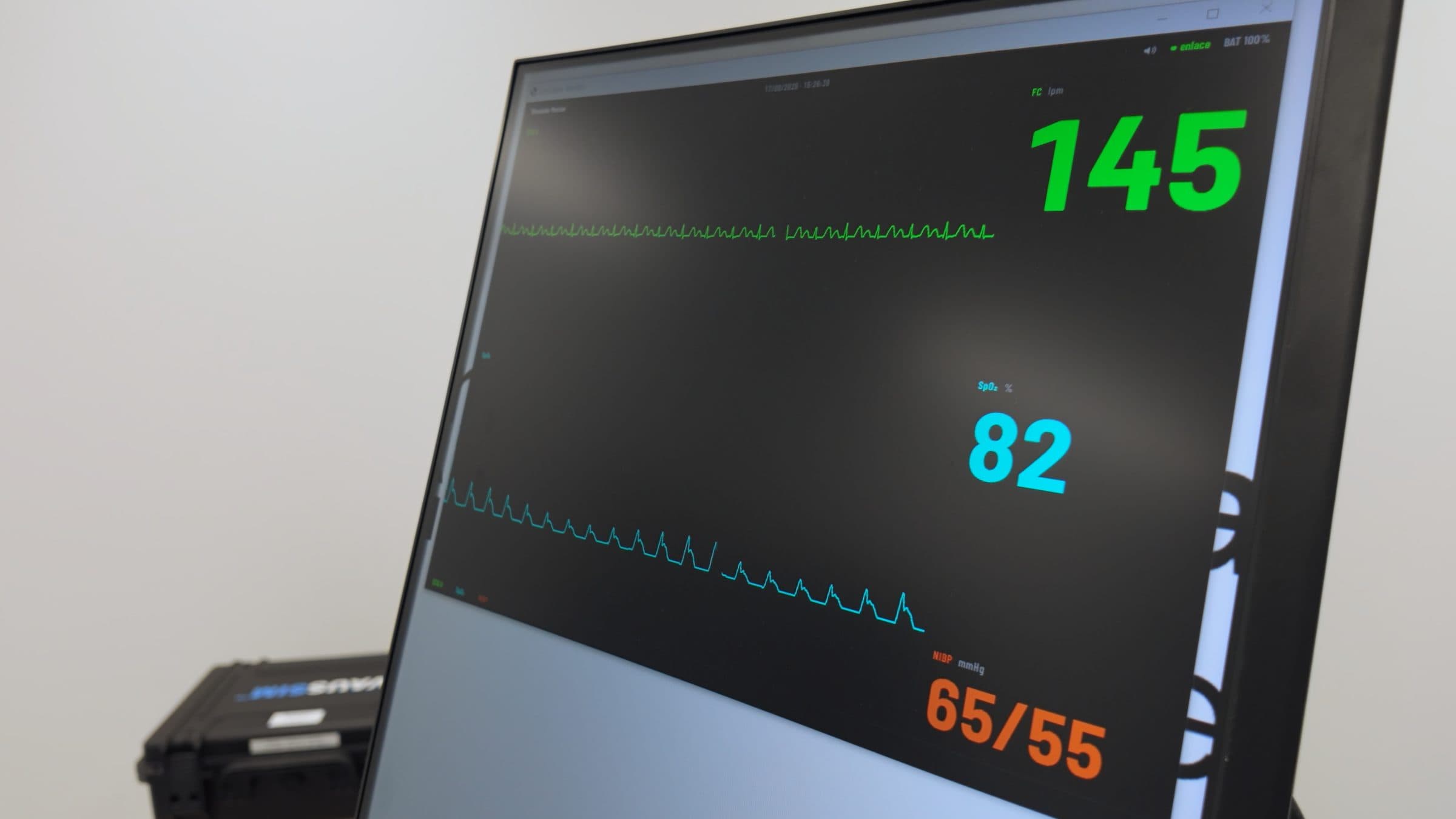 Pantalla del Simulador de Monitor de Constantes Vitales con frecuencia cardíaca de 145, saturación de 82 y presión arterial de 65/55.